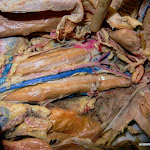 abdominal_aorta.JPG