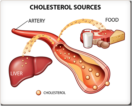 cholesterol cholesterol