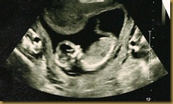 MaryAnn ultrasound
