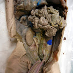 fetal_pig_ureter04.JPG
