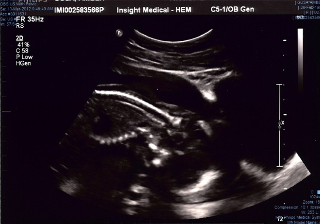 20120313 ultrasound (1)