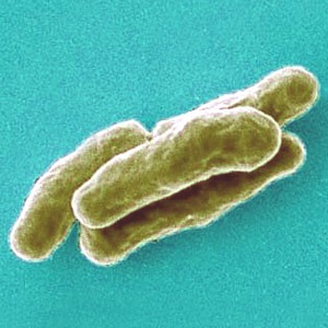 [Mycobacterium_tuberculosis1%255B4%255D.jpg]