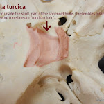 skull_sella_turcica_labeled.JPG