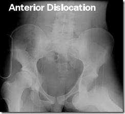 anterior