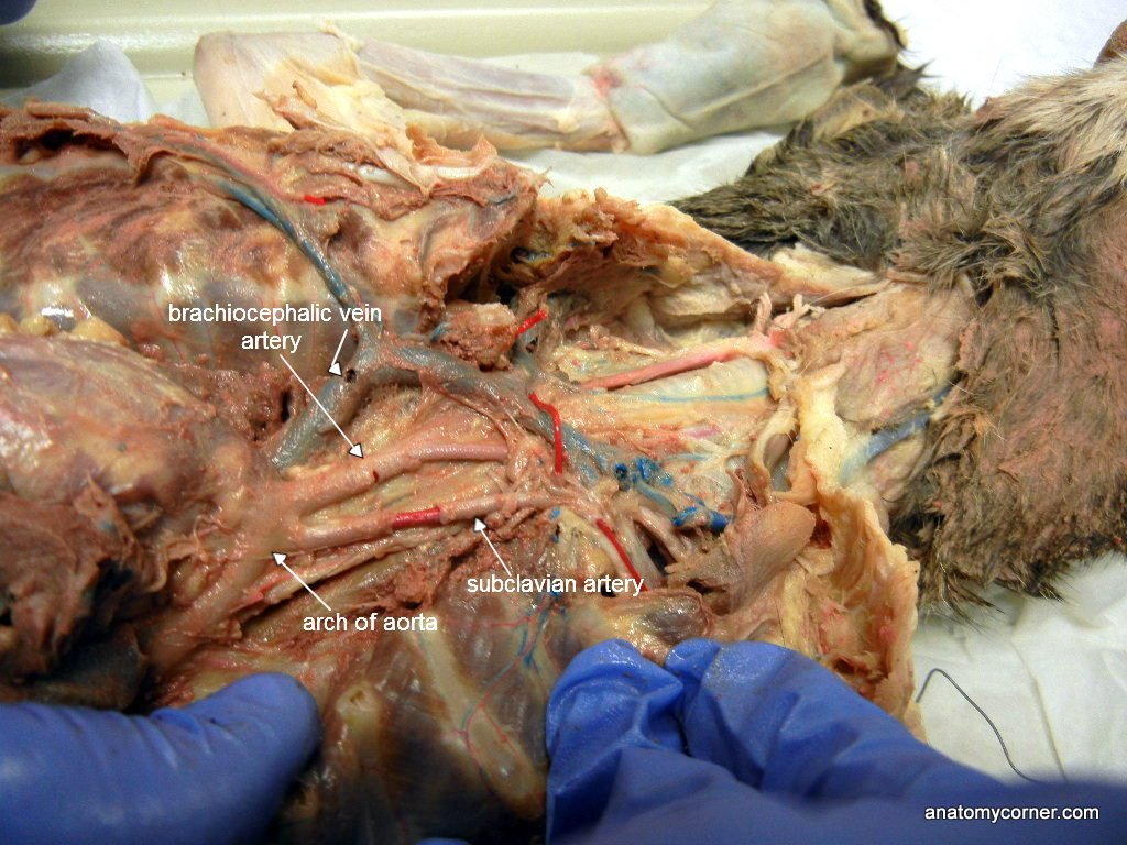 brachiocephalic_artery_L.JPG