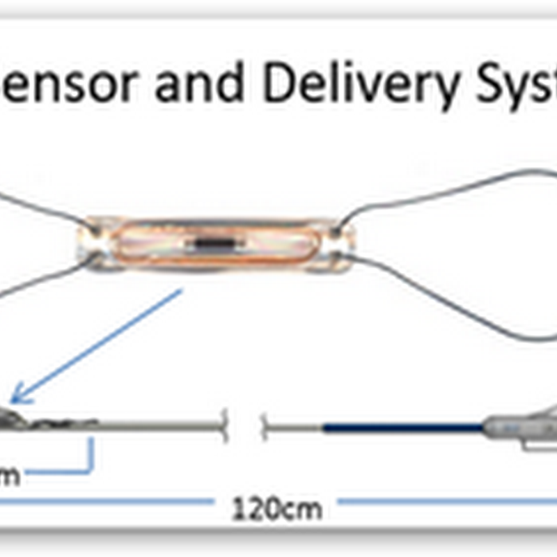 FDA Approves CardioMEMS For Patients Who Have Been Hospitalized For Heart Failure-First Implantable Wireless Device With Remote Monitoring