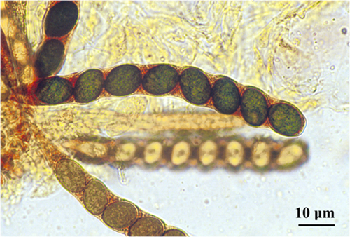 A linear, cylindrical, eight-spored ascus of Sordaria fimicola