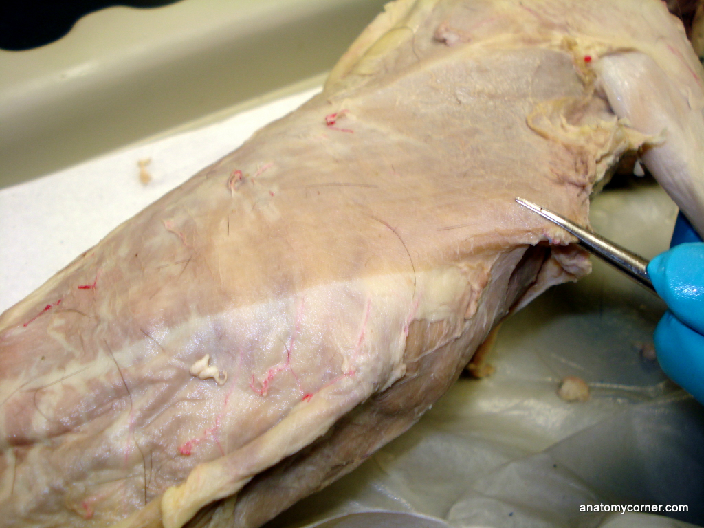latissimus.JPG