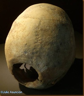Cráneo trepanado del dolmen de Aizibita - Cirauqui - Museo de Navarra Cráneo trepanado del dolmen de Aizibita - Cirauqui - Museo de Navarra