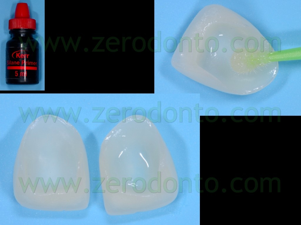 [107-silanizzazione-con-silano-faccet%255B1%255D.jpg]