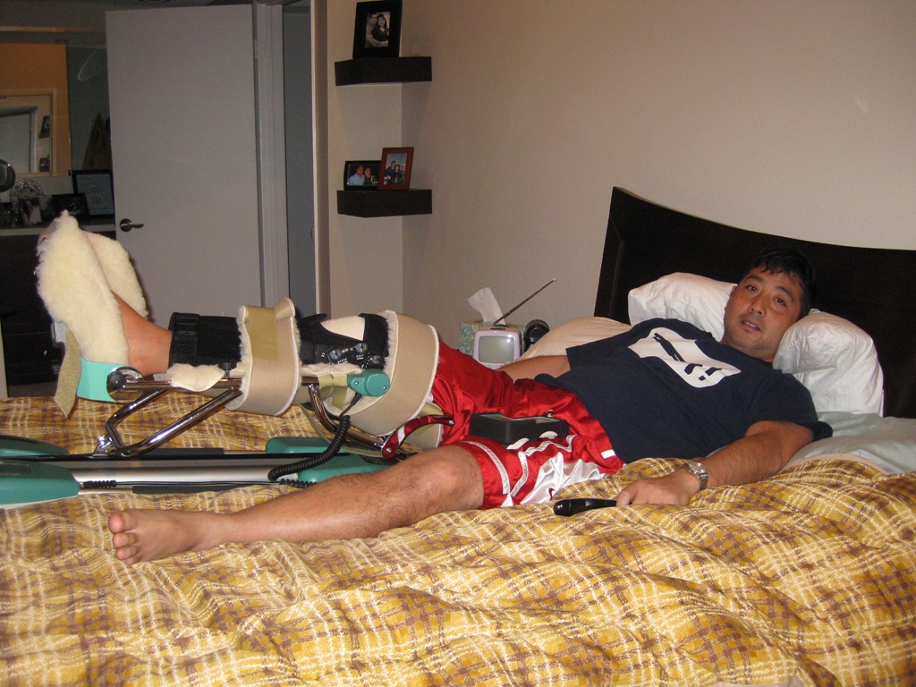 [acl_surgery_day3%255B3%255D.jpg]