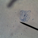 cheek05.jpg