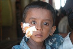 wounded-tamil_child