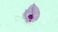 Trichomonas_Giemsa_DPDx