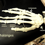 hand_metacarpals _labeled.JPG