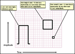 325px-ECG_Paper_v2.svg 325px-ECG_Paper_v2.svg