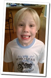 jakes-tooth jakes-tooth