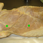 trapezius.jpg