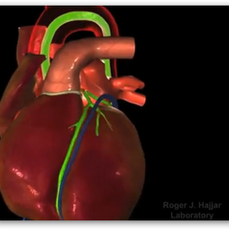 Celladon Mydicar Treatment Gets FDA Approval - Breakthrough Treatment for Patients With Heart Failure Due to Systolic Dysfunction, Process Uses Single Injection Genetic Enzyme Replacement Therapy