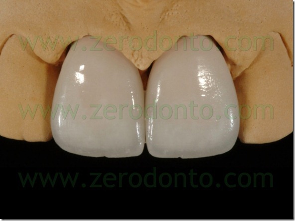 92 rifinitura superficie faccette ceramica