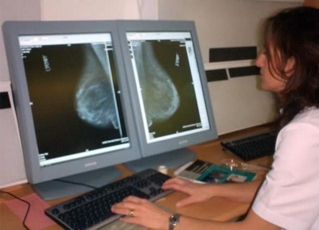 [Foto_mamografia._dexeus.com%255B3%255D.jpg]