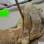rectus_femoris.jpg