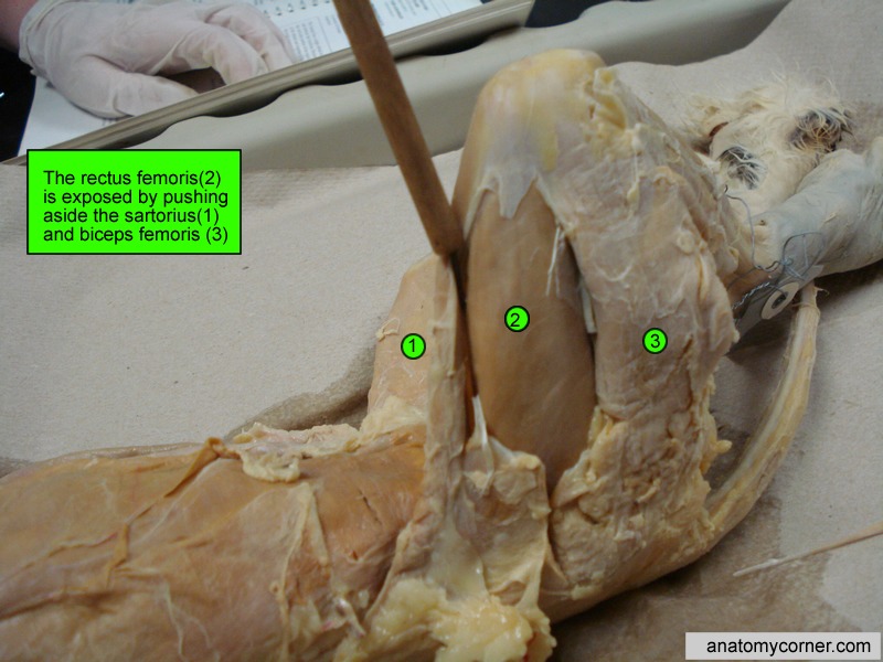 Rectus Femoris Jpg