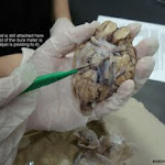 brain_dissect15.jpg brain_dissect15.jpg