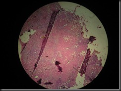 cirrhosis liver high resolution histology slide tsnaps