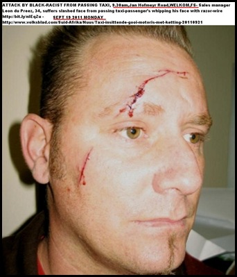DU PREEZ LEON Welkom was whipped from taxi with razor-covered chain Sept192011