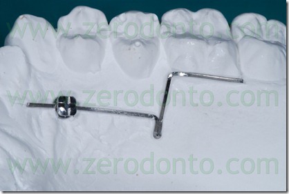 17 miniviti con foro 17 miniviti con foro