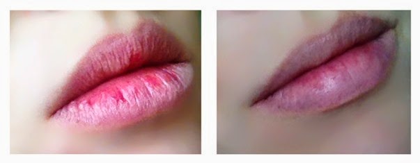 Antes e depois2 Antes e depois2