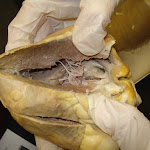 heart_left_ventricle.jpg heart_left_ventricle.jpg