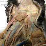 transverse_jugular_L.JPG