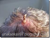 larva lalat bot manusia larva lalat bot manusia