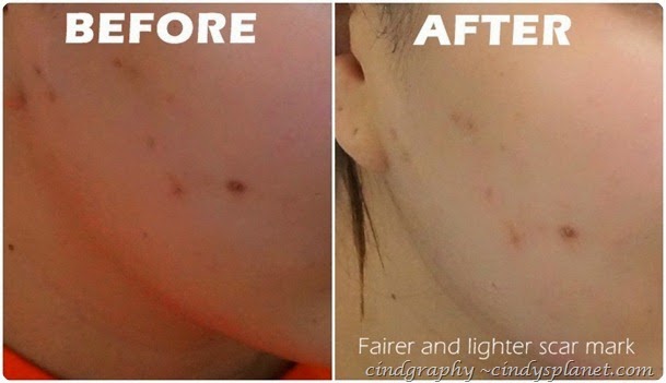 Kose Sekkisei Lotion Emulsion Kose Sekkisei Lotion Emulsion
