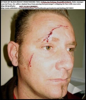 DU PREEZ LEON Welkom was whipped from taxi with razor-covered chain Sept192011