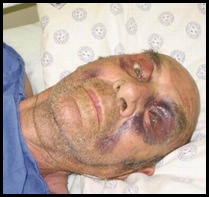 POTTIE POTGIETER WINBURG WELKOM LEFT FOR DEAD 5 BL ATTACKERS WINBURG JAN182012 POTTIE POTGIETER WINBURG WELKOM LEFT FOR DEAD 5 BL ATTACKERS WINBURG JAN182012