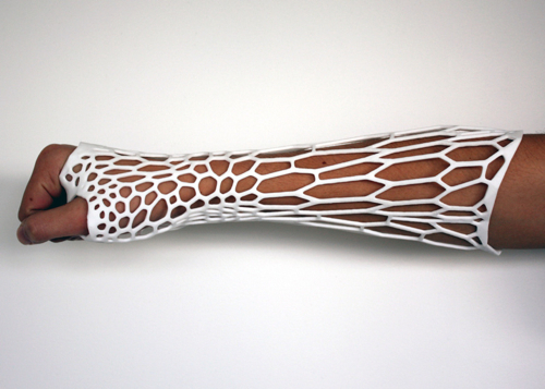 Dezeen Cortex 3D printed cast for broken bones by Jake Evill 2 500