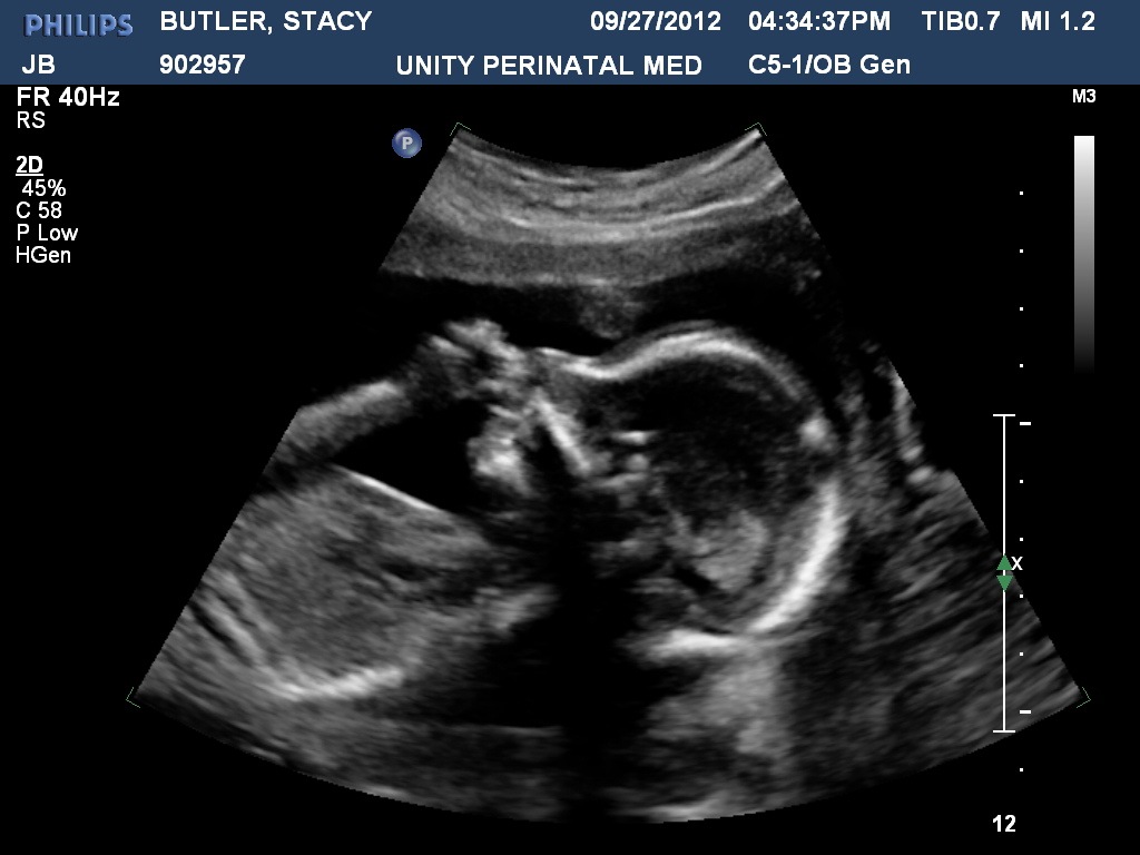 [BUTLERSTACY20120927163437731%255B1%255D.jpg]