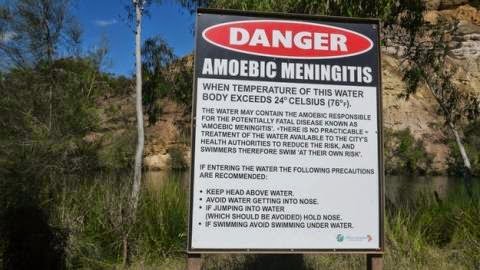 Amoebic-meningitis-480x270.jpg