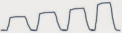 capnography simpified 2 capnography simpified 2