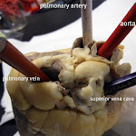 heart_back_pulmonary_vena_cava_labeled.JPG