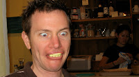 Teeth implants
