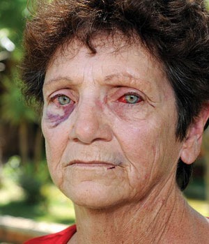 [BADENHORST%2520ALET%252064%2520bloodied%2520beaten%2520eyes%2520she%2520and%2520husband%2520Paul%252057%2520ATTACKED%2520AT%2520SKEERPOORT.jpghusband%255B6%255D.jpg]