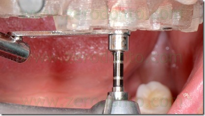 blog.081 blog.081