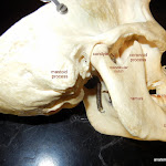 skull_mastoid_labeled.JPG