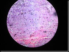 chondroma  high resolution histology slide tsnaps