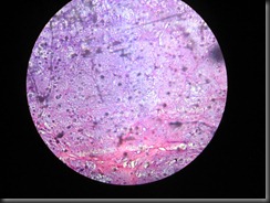 chondroma high resolution histology slide tsnaps chondroma high resolution histology slide tsnaps