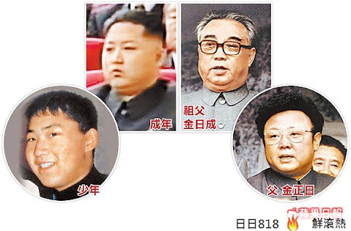 肖似祖父金日成 金正恩疑整形